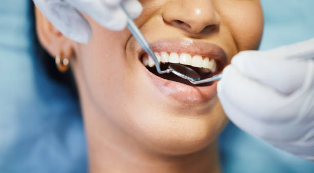 Best Weekend Emergency Dentist in Pine Mountain Clu, CA