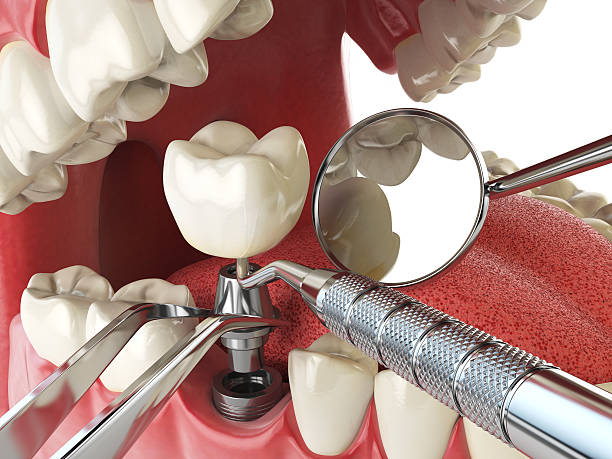 Best Orthodontic Emergency Dentist in Pine Mountain Clu, CA